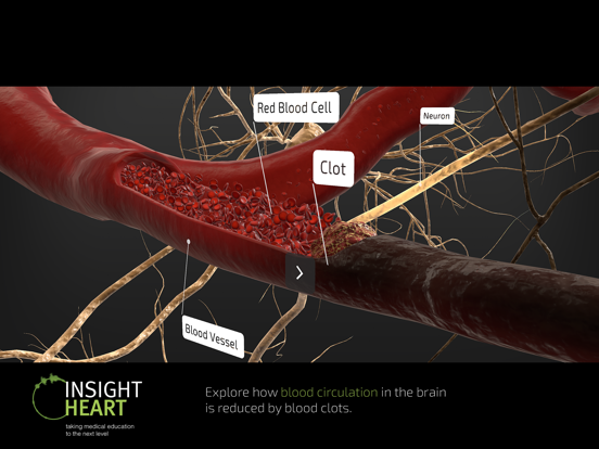 INSIGHT HEART screenshot 5