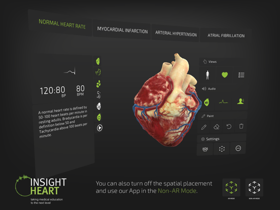 INSIGHT HEART screenshot 9