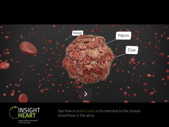 INSIGHT HEART screenshot 3