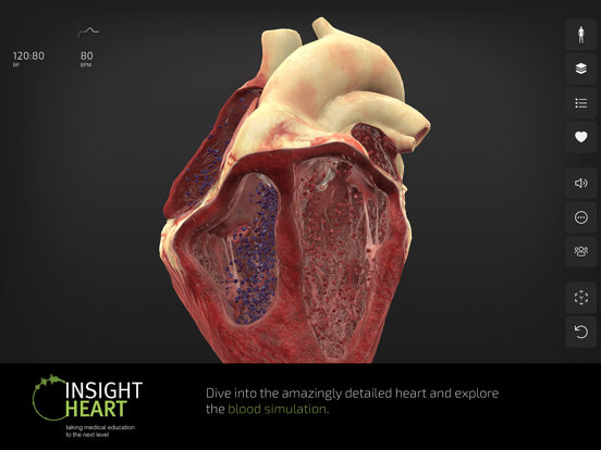 INSIGHT HEART screenshot 7
