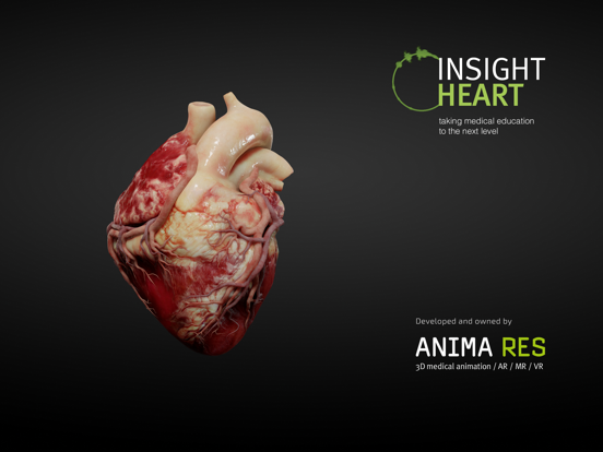 INSIGHT HEART screenshot 1