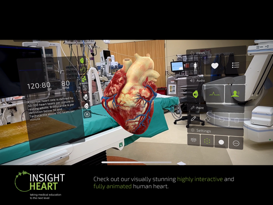 INSIGHT HEART screenshot 8