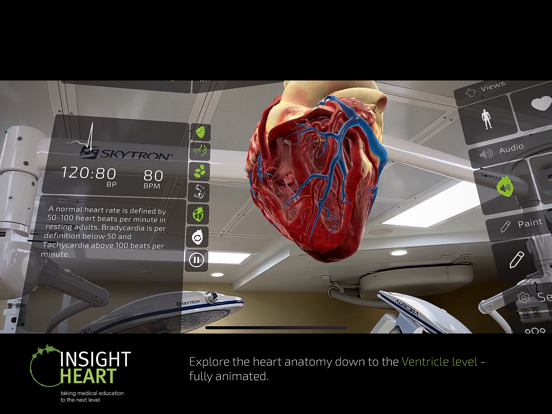 INSIGHT HEART screenshot 4