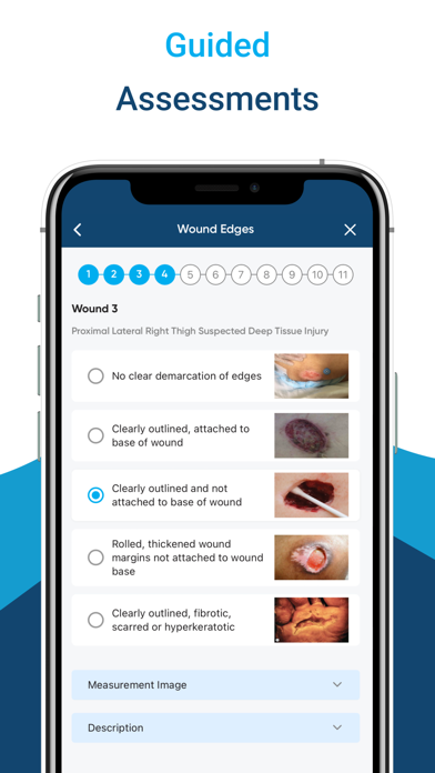 InteliWound screenshot 3