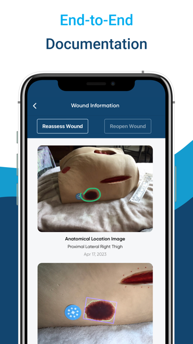 InteliWound screenshot 1