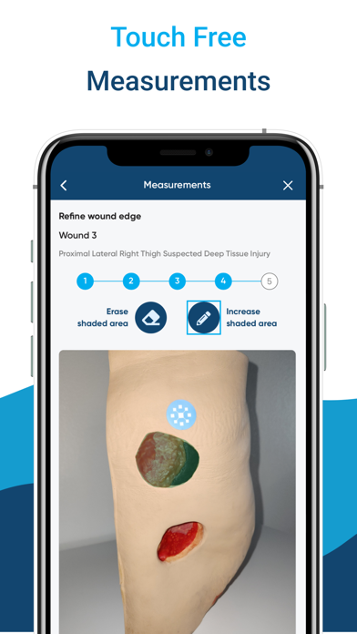 InteliWound screenshot 4