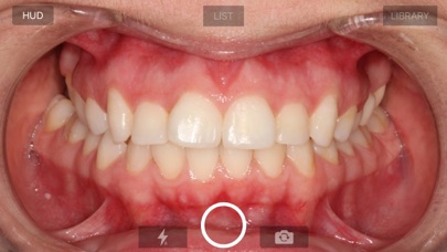 IOC Snapshot Camera screenshot 1