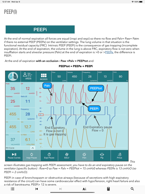 iVentilate screenshot 4