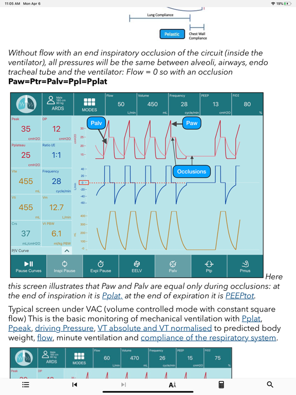 iVentilate screenshot 5