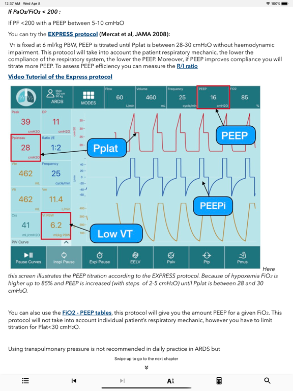 iVentilate screenshot 3