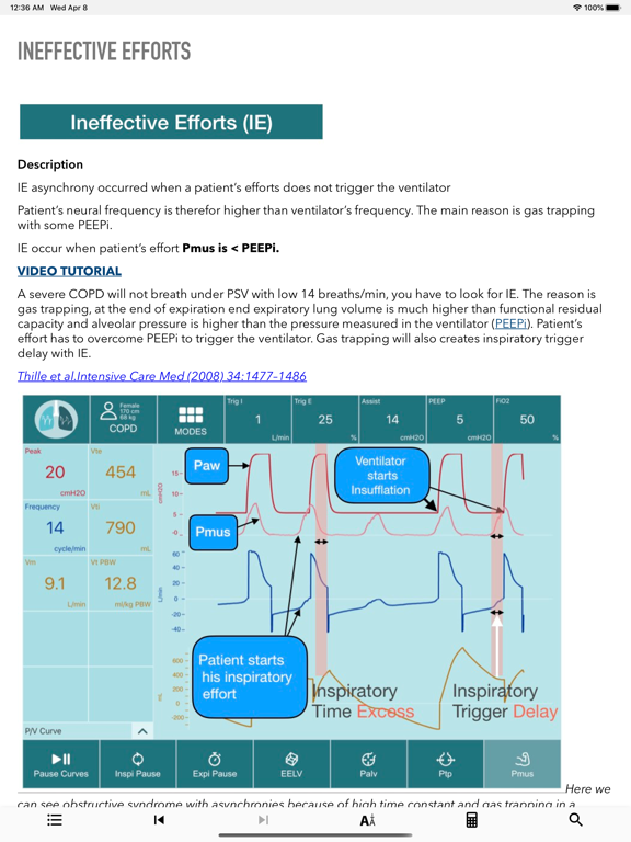 iVentilate screenshot 2