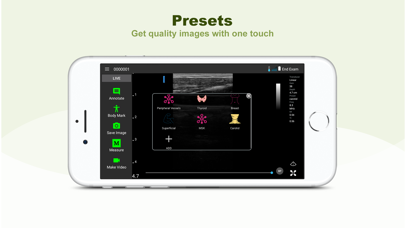 LELTEK Ultrasound - LeSono screenshot 1