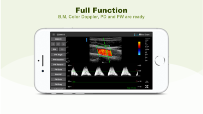 LELTEK Ultrasound - LeSono screenshot 2