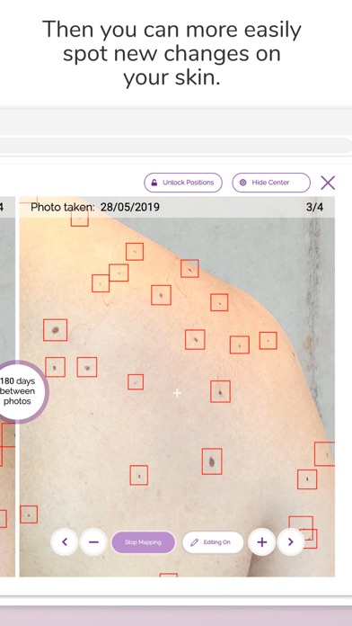 Miiskin: Rx Dermatology Visits screenshot 3