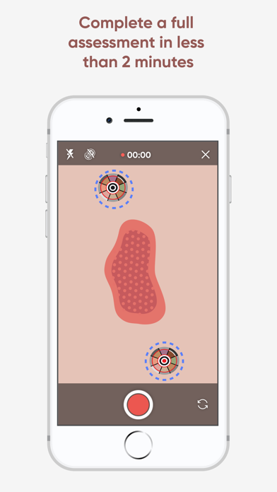 Minuteful for Wound screenshot 2