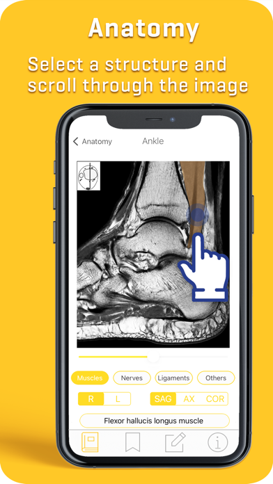 MRI-ESSENTIALS: MSK imaging screenshot 2