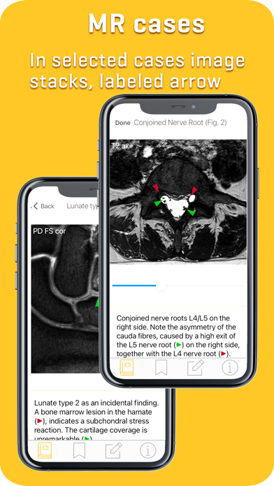 MRI-ESSENTIALS: MSK imaging screenshot 3