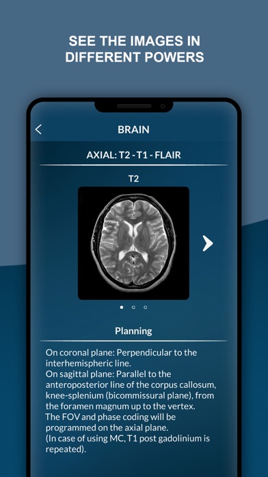 MRI - Protocolos de Resonancia screenshot 1