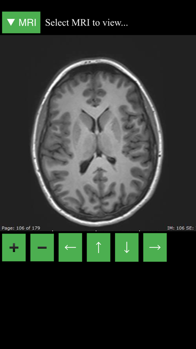 MRI Viewer screenshot 5