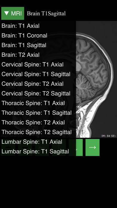 MRI Viewer screenshot 1