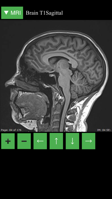 MRI Viewer screenshot 4