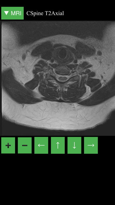 MRI Viewer screenshot 2