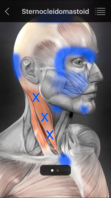 Muscle Trigger Points screenshot 4