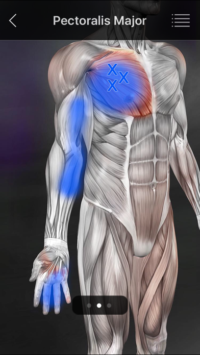 Muscle Trigger Points screenshot 2