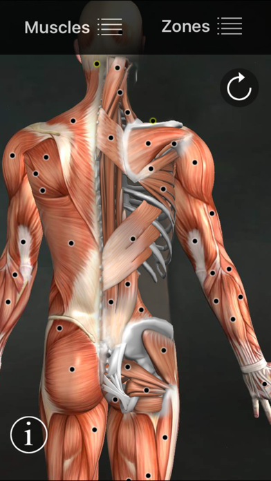 Muscle Trigger Points screenshot 5
