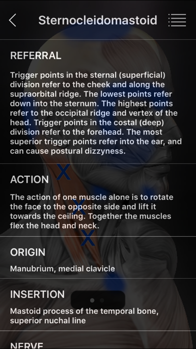 Muscle Trigger Points screenshot 3