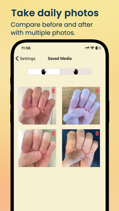 NailKeeper - Stop Biting Nails screenshot 2