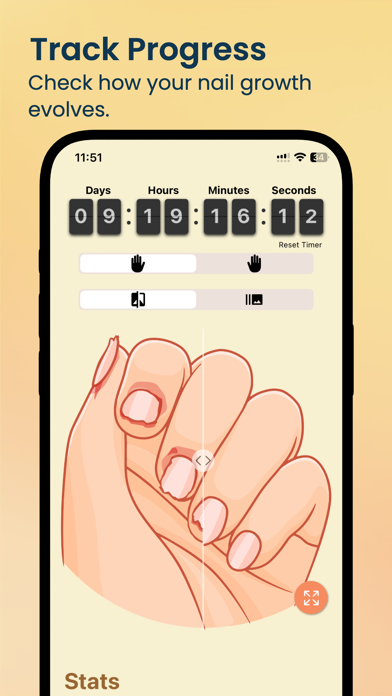 NailKeeper - Stop Biting Nails screenshot 6