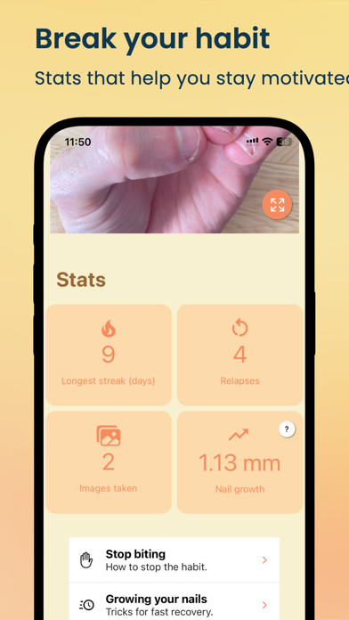 NailKeeper - Stop Biting Nails screenshot 5