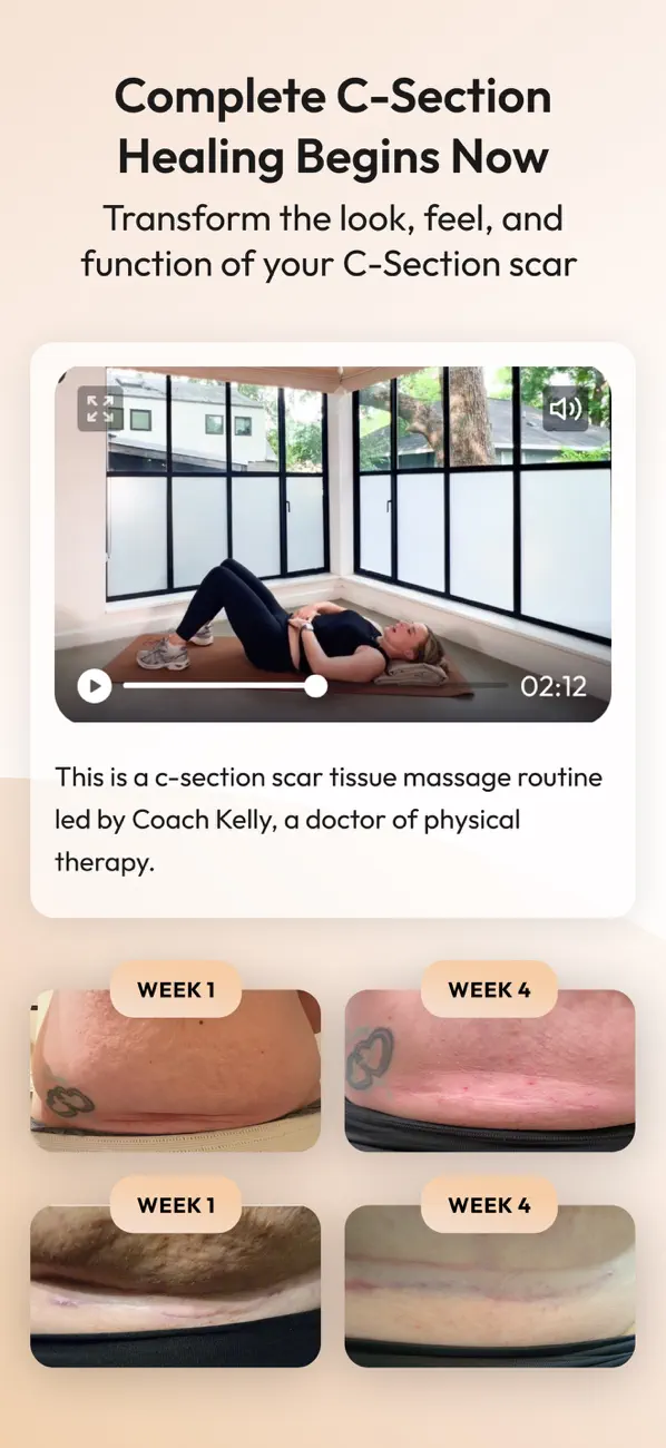 Natal - Pregnancy & Postpartum screenshot 3