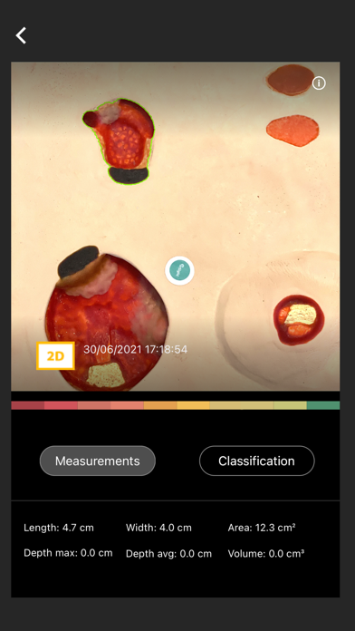 NATROX® IQ Advanced Wound Hub screenshot 3
