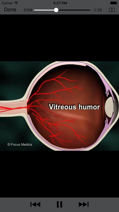 Ophthalmology - Understanding Disease screenshot 1
