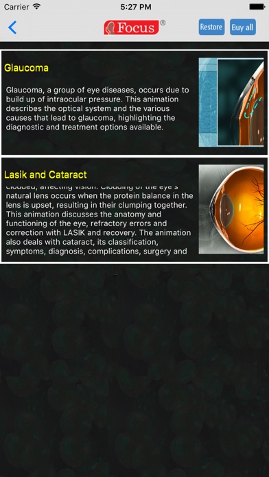 Ophthalmology - Understanding Disease screenshot 3
