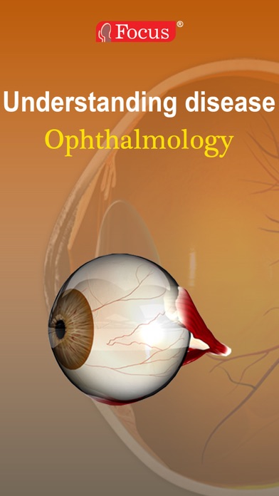 Ophthalmology - Understanding Disease screenshot 4