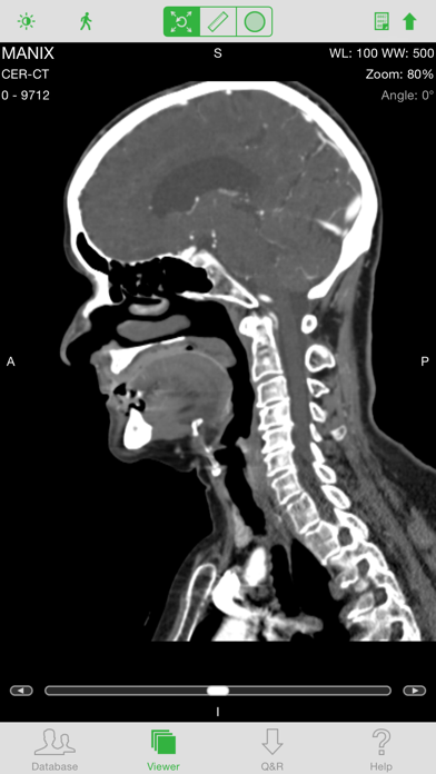 OsiriX HD screenshot 5
