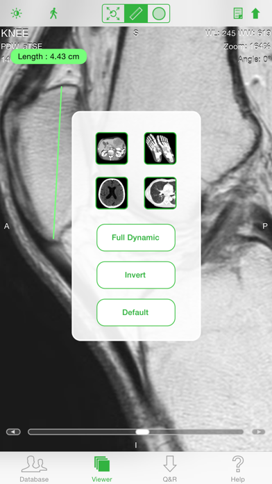 OsiriX HD screenshot 3