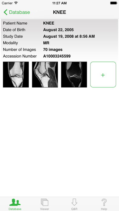 OsiriX HD screenshot 2