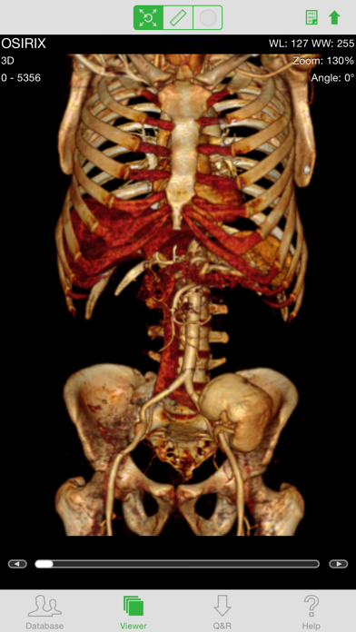 OsiriX HD screenshot 4