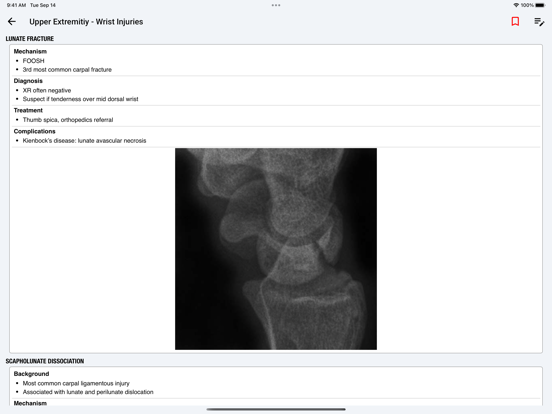 palmEM AI: EM Quick Reference screenshot 2