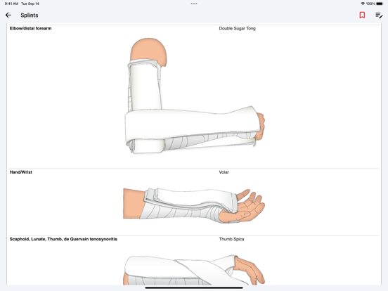 palmEM AI: EM Quick Reference screenshot 8