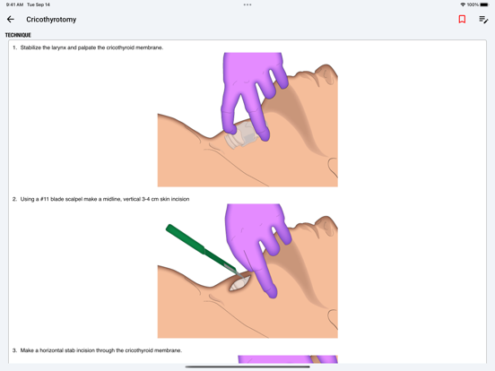 palmEM AI: EM Quick Reference screenshot 4