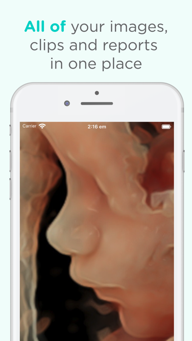Pim - Your Medical Images screenshot 2