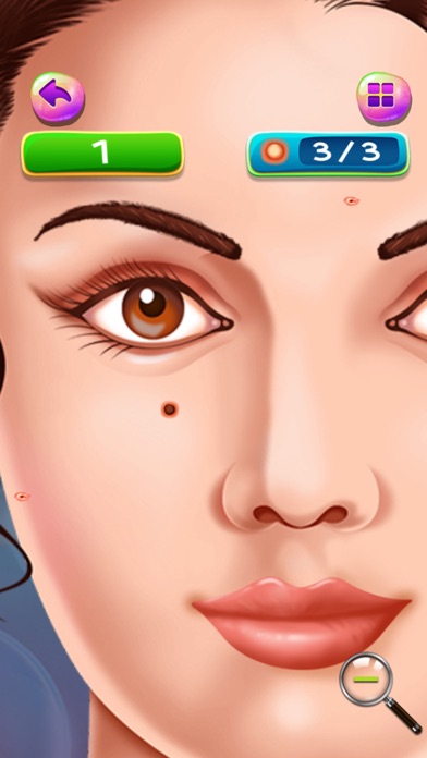 Pimples and Blackheads Removal : get rid of pimples from nose and face ! FREE screenshot 3