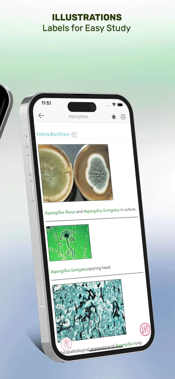 Pkt Guide to Fungal Infections screenshot 4