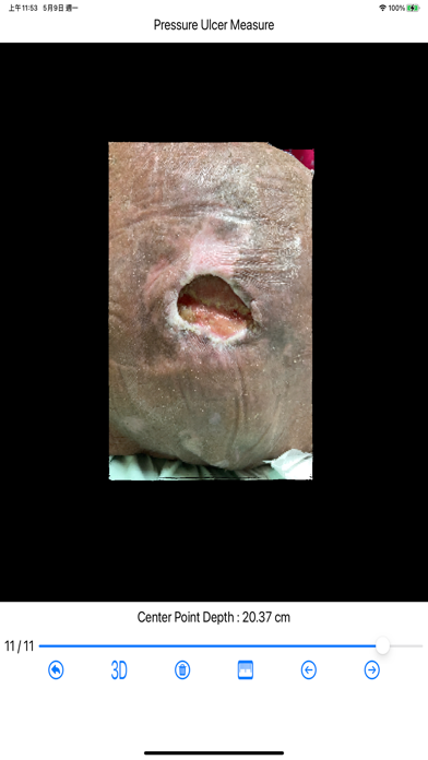 Pressure Ulcer Measure screenshot 5