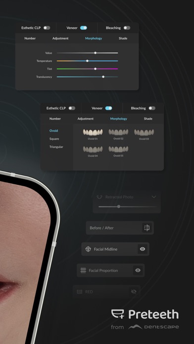Preteeth AI Pro screenshot 4